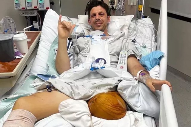 В Калифорнии мужчине ампутировали обе ноги после того, как он спас своих детей от засасывания в снегоуборочную машину.
