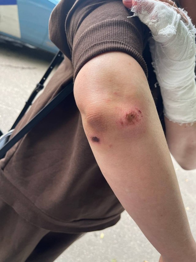 В подмосковном Одинцово банда на самокатах напала и ограбила женщину