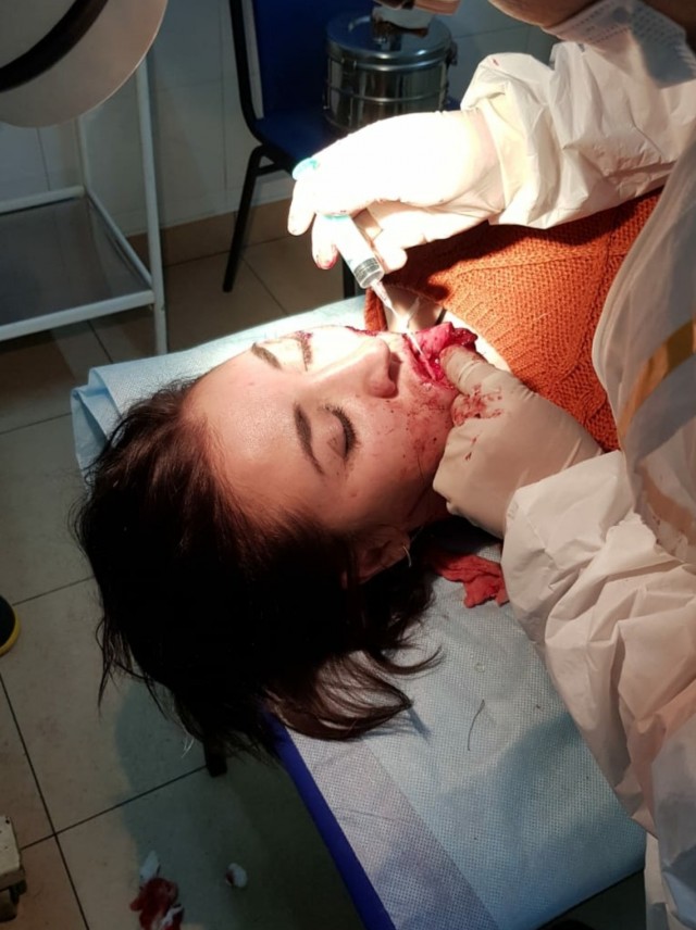 Нападение собаки