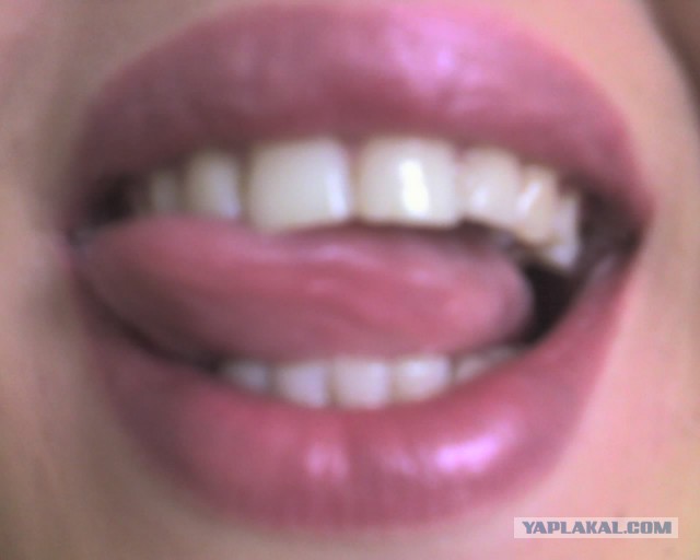 Зубы замучили, постоянные с ними проблемы