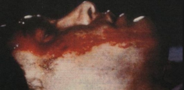 Выстрел в звезду: знаменитости, которых застрелили