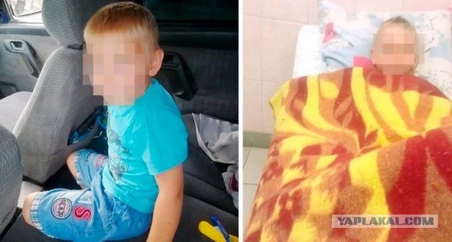 У умершего во Владимире 5-летнего мальчика при эксгумации не обнаружили почек