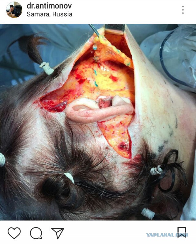 Самарский врач-анестезиолог усыпил и изнасиловал пациентку