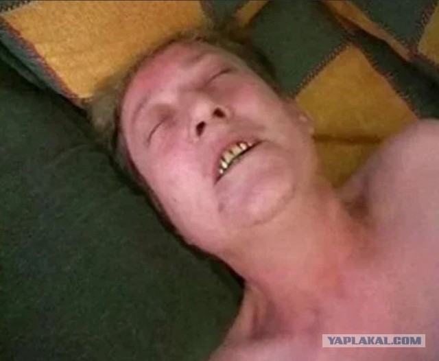 Голливудская улыбка