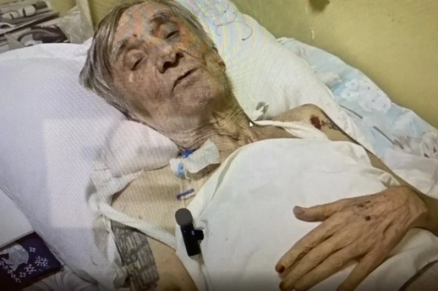 Дело возбудили после смерти мужчины от кипятка в Обнинске