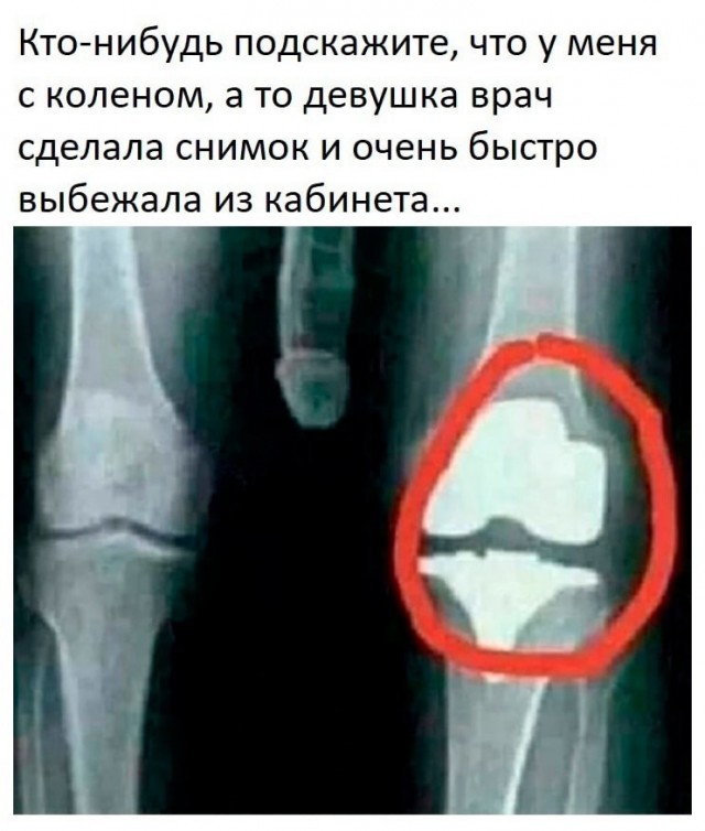Бредзона 05.06.21