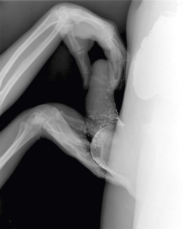 Художник запечатлел процесс секса в рентгеновских лучах