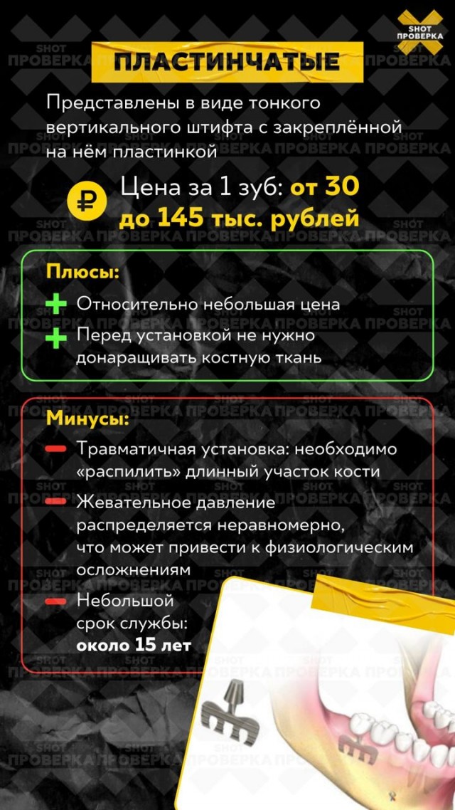 Установка зубных имплантов может обойтись вам в стоимость однушки в Подмосковье