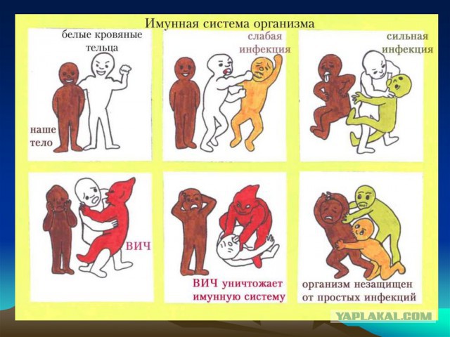 Очередная отрицательница ВИЧ умерла от последствий ВИЧ
