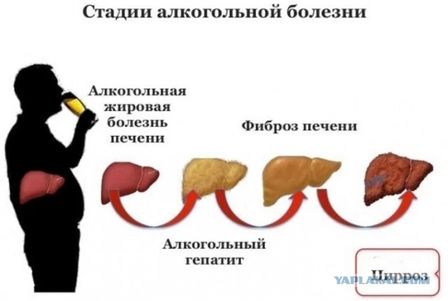 Больную пневмонией москвичку оставили умирать на лавочке у подъезда