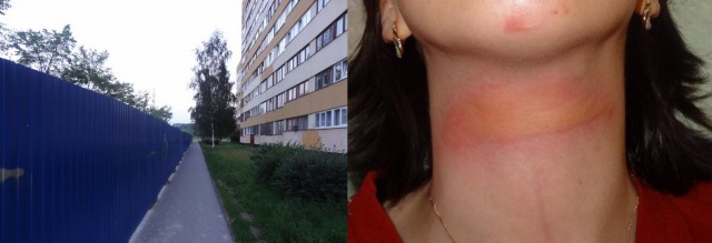Ублюдки натянули трос на тропинке