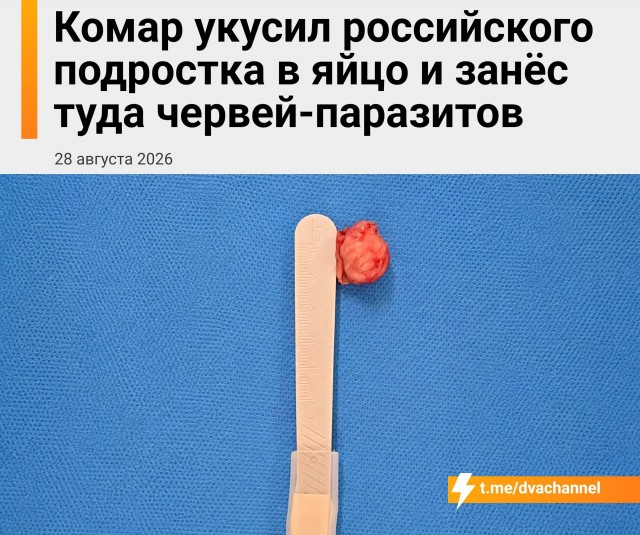 Комар укусил россиянина в яичко и заразил его паразитами
