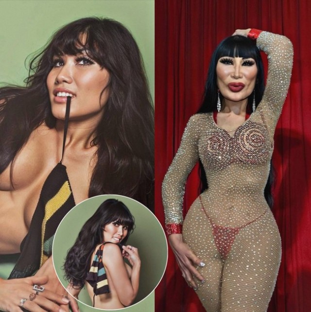 Пугачева, Михайлов и Ко. Странная мода на надувные физиономии