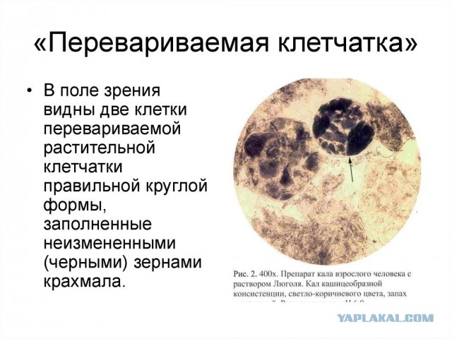 Божественная клетчатка (история о которой невозможно молчать)