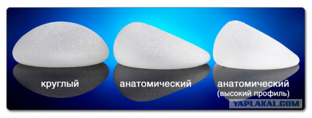 Предметы с пожизненной гарантией