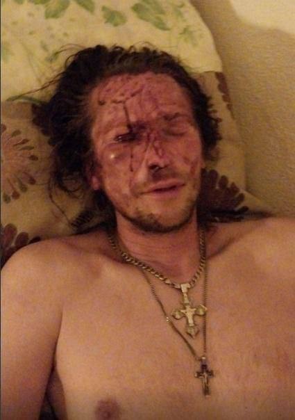 Избитый в Анапе турист записал извинения