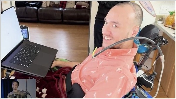 Пациент с имплантом Neuralink сумел смонтировать и озвучить видео с помощью мыслей