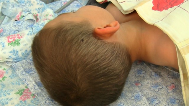 В Новосибирске родители сутки не замечали тяжёлую травму головы у 4-летнего сына