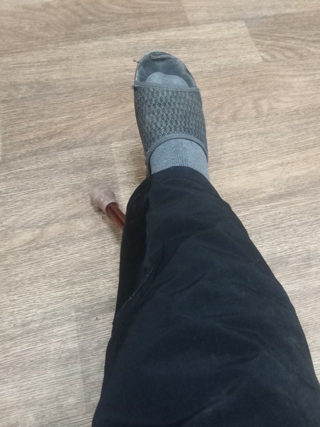 Ну вот и перелом