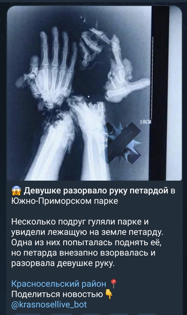 Юноше оторвало кисть на фуд-корде ТЦ в Нижнем Новгороде от взрыва петарды