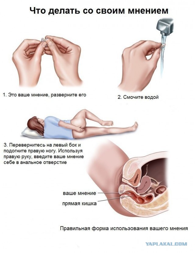 Прямая трансляция марша мира!