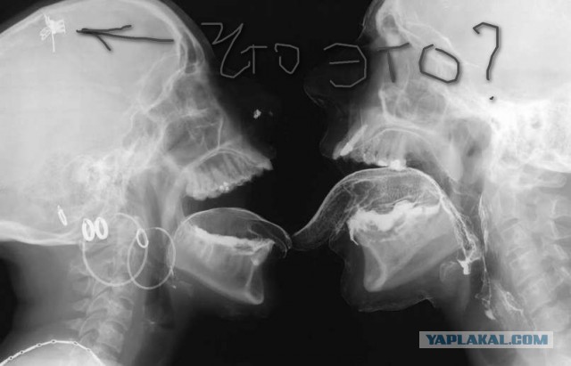 Художник запечатлел процесс секса в рентгеновских лучах