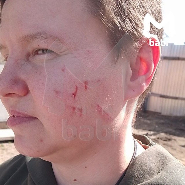 Яжмать расцарапала лицо таксистке в Иркутске