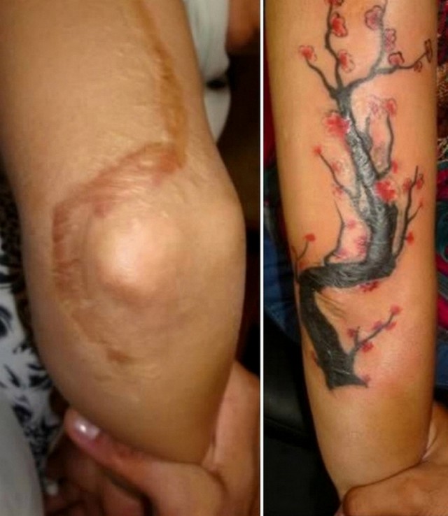 Татуировки, маскирующие дефекты внешности