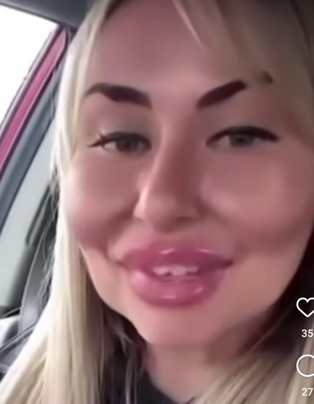 Утиные губы как маркер...