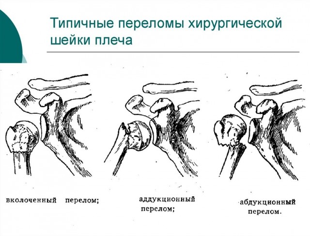 В Челнах из-за конфликта с курильщиком в подъезде скончался человек