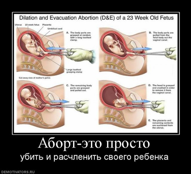 Демотиваторов пост, добавляйте свои