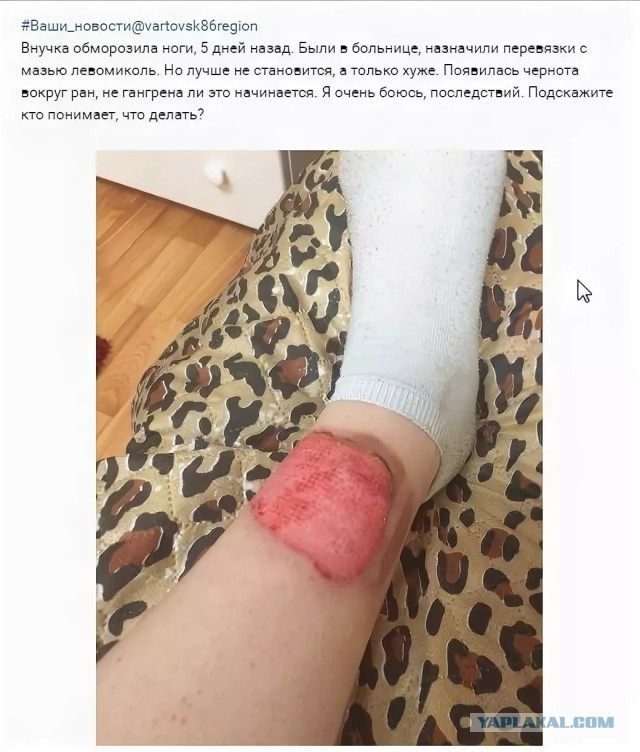 Понимаю: мода, молодёжь, но рукалицо!