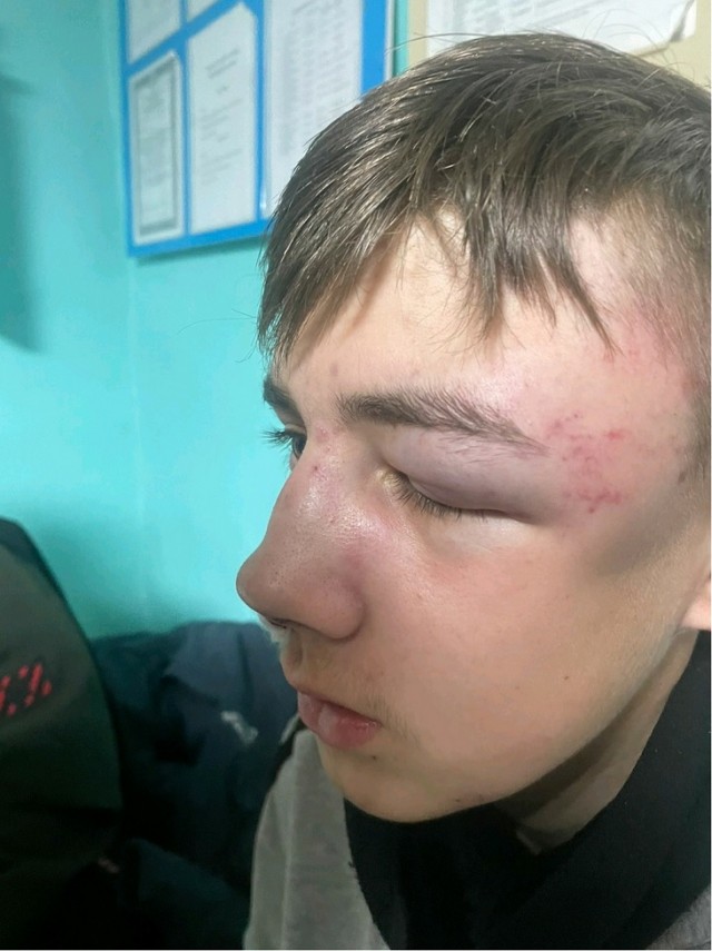 Учитель избил школьника в бурятском селе. Ребёнка пришлось оперировать