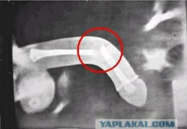 Дальнобойщик сломал себе член, соскучившись по девушке
