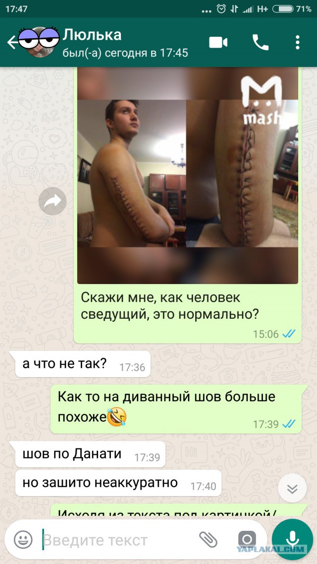 История одной операции