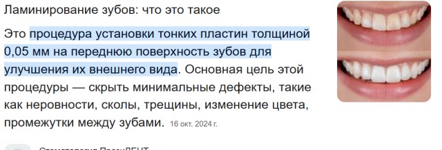 Внимание: последствия установки виниров на все зубы