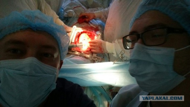 Искусственное кровообращение