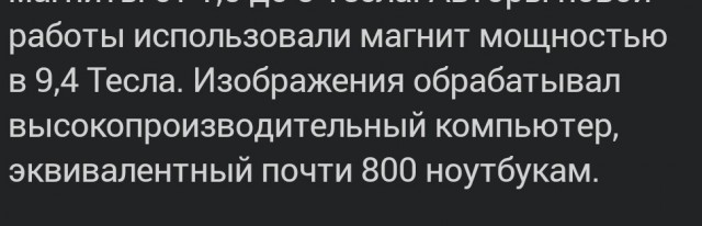 Физики улучшили качество снимков МРТ в 64 миллиона раз и рассмотрели отдельные клетки мозга