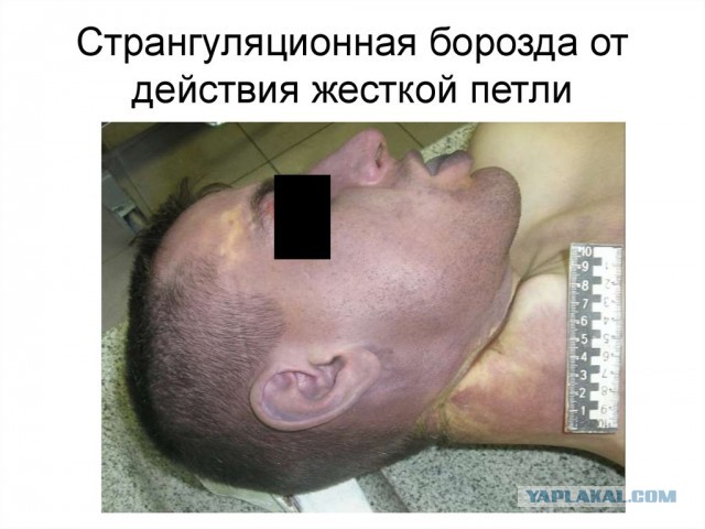 Отец Тесака осмотрел труп сына. На теле следы пыток