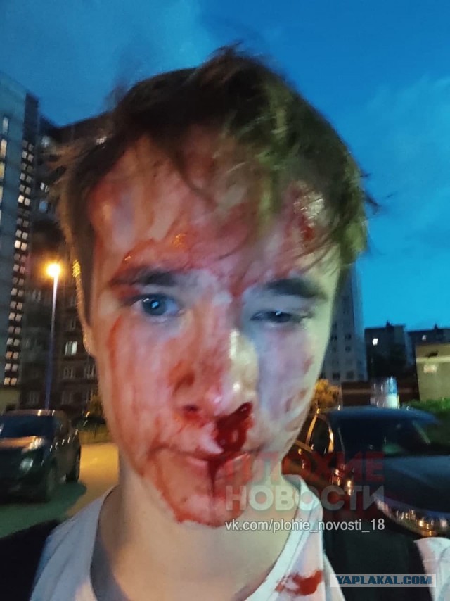 В ночь на воскресенье в Санкт-Петербурге двое великовозрастных кавказцев избили 16-летнего парня