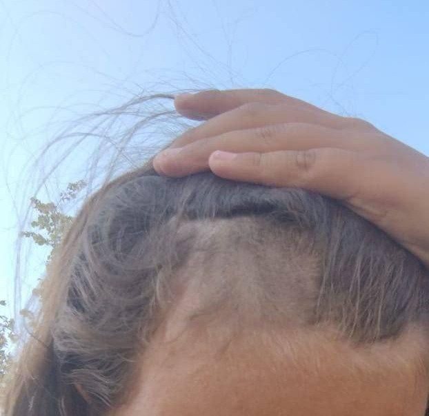 В Дрожжино неизвестные подростки постригли девочку из-за замечания