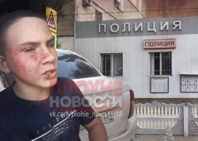 "Я уже был готов умереть": в Волгограде полицейские избили 14-летнего парня, ошибочно приняв за "закладчика"