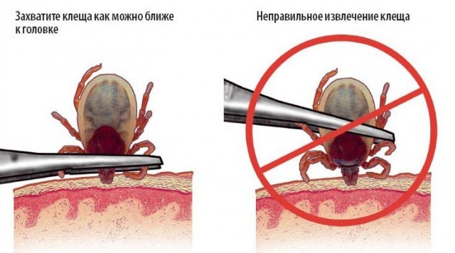 Клещ укусил