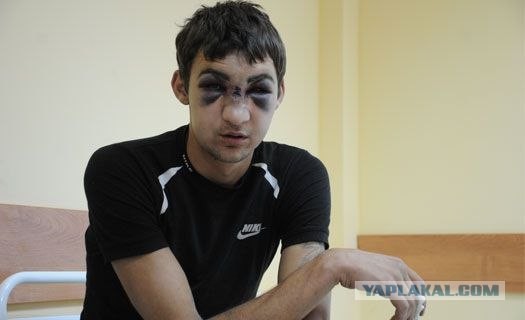 Парня чуть не убили за бутылку воды