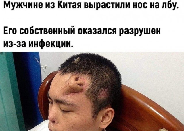 Бредзона 31.01.21