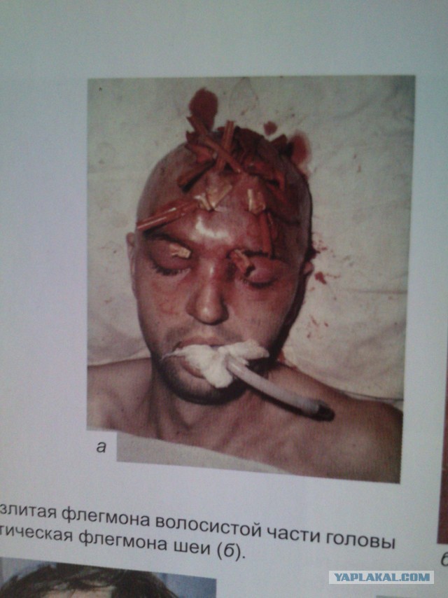 «Я пережил пытки в реанимации и остался инвалидом»