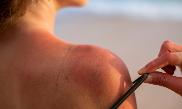 До 1000 рублей будут штрафовать россиян за загар в жару, — юристы