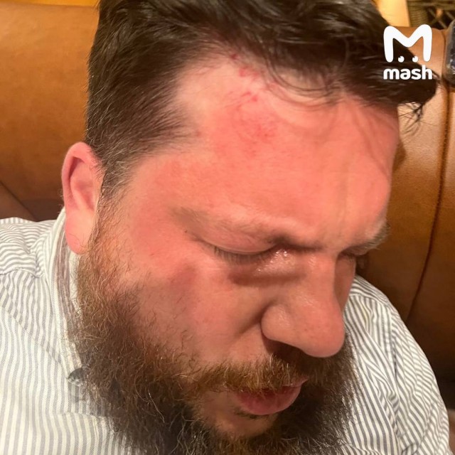 Иноагента избили в Вильнюсе