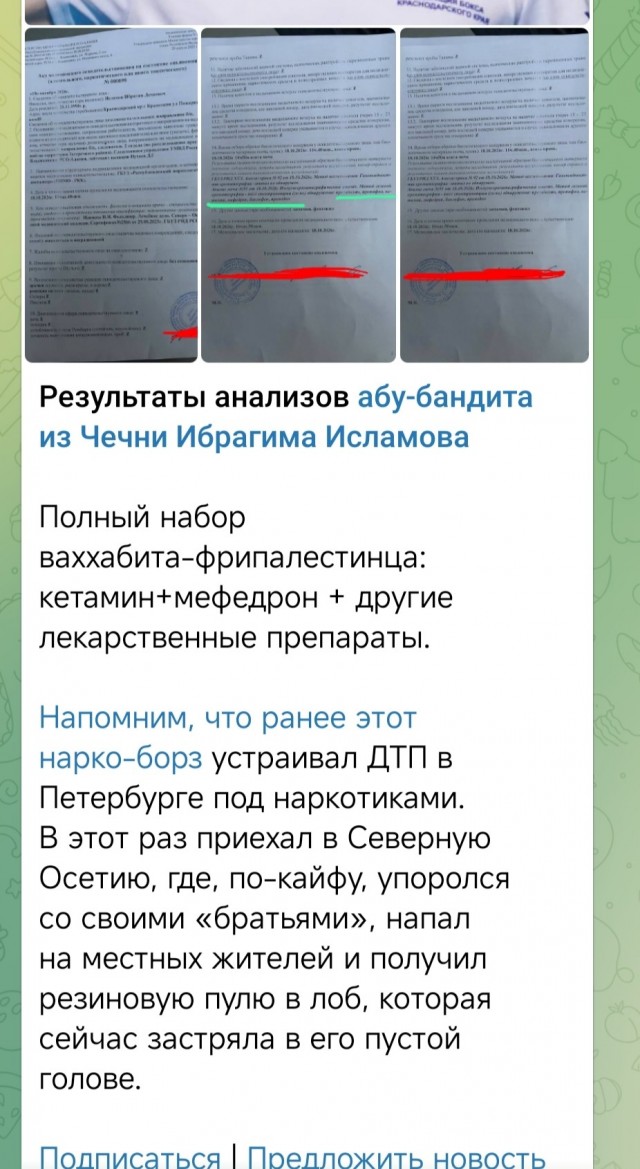 Размахивал ногами - оказался в реанимации: чеченский боец ММА Ибрагим «Никархо» Исламов госпитализирован после спора в осетинами.