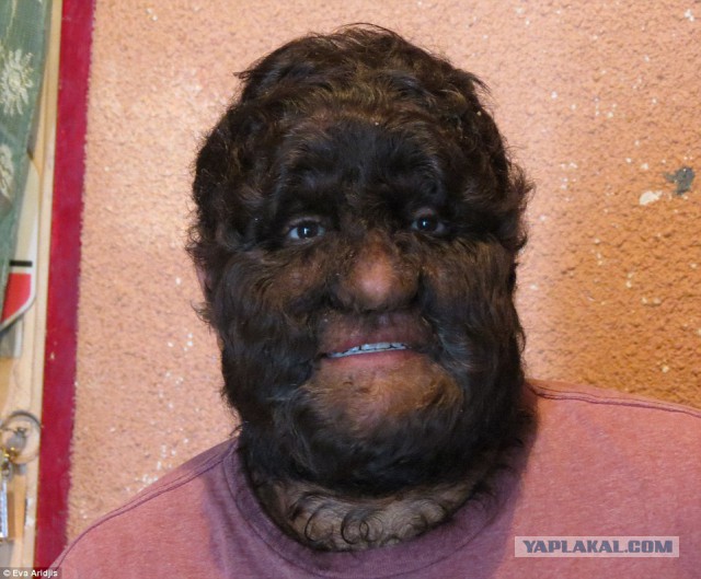 «Быть волосатой — это не страшно»: 19-летняя студентка принципиально не прикасается к бритве